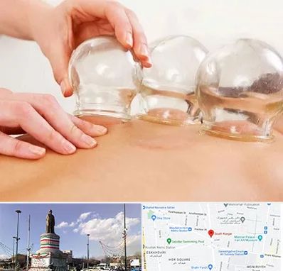 بادکش درمانی در کارگر جنوبی