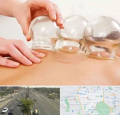 بادکش درمانی در منطقه 17 تهران