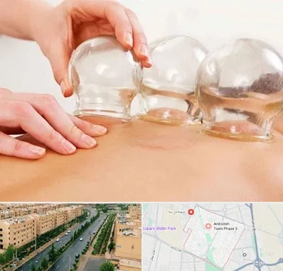 بادکش درمانی در فاز سه اندیشه