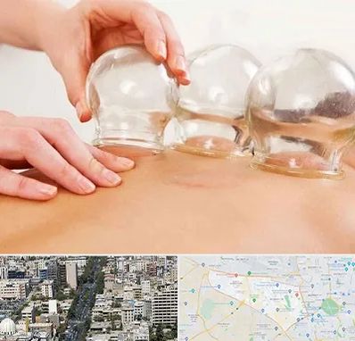 بادکش درمانی در منطقه 18 تهران