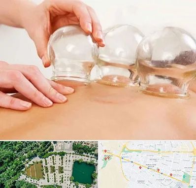 بادکش درمانی در وکیل آباد مشهد