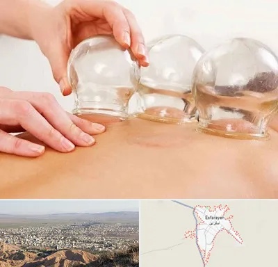 بادکش درمانی در اسفراین