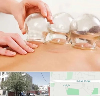 بادکش درمانی در طرشت