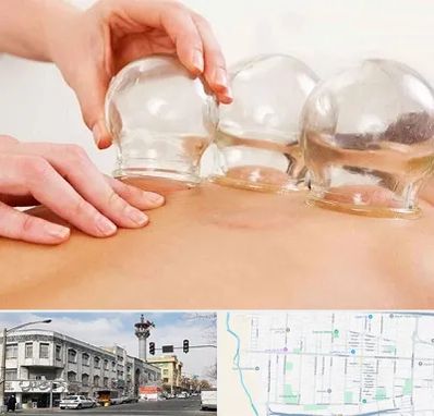 بادکش درمانی در 17شهریور