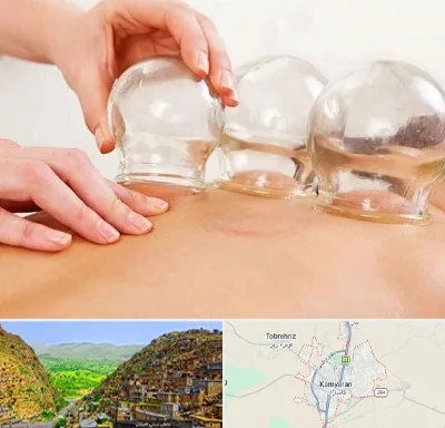 بادکش درمانی در کامیاران