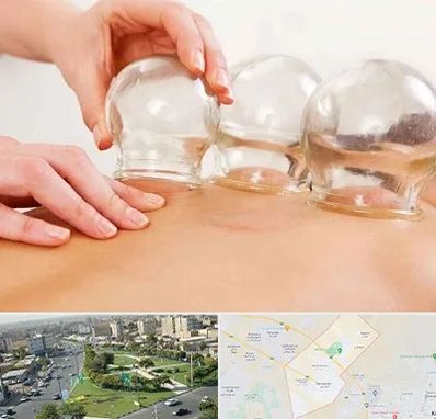 بادکش درمانی در کمال شهر کرج