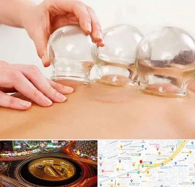 بادکش درمانی در میدان ولیعصر