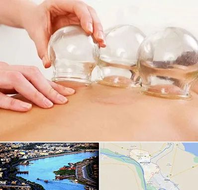 بادکش درمانی در خرمشهر