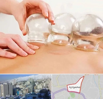 بادکش درمانی در محمودیه