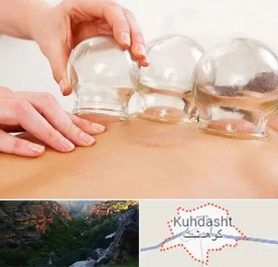 بادکش درمانی در کوهدشت