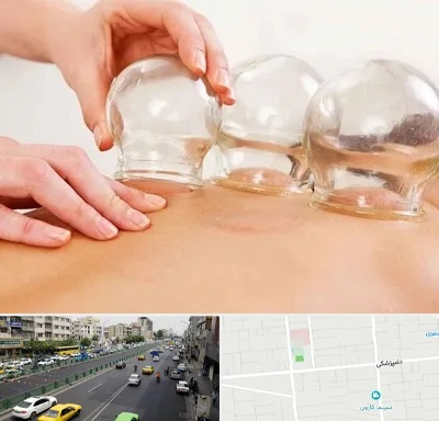 بادکش درمانی در خیابان دامپزشکی