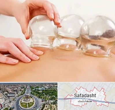 بادکش درمانی در صفادشت
