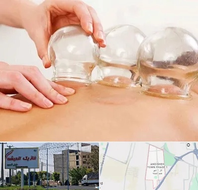بادکش درمانی در فاز یک اندیشه