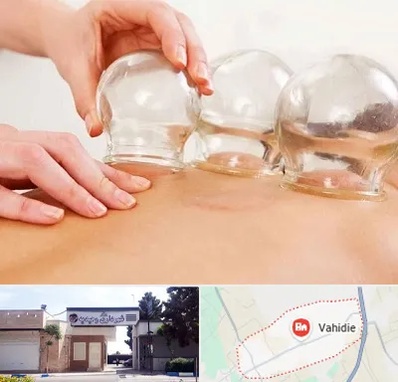 بادکش درمانی در وحیدیه شهریار