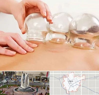 بادکش درمانی در زابل