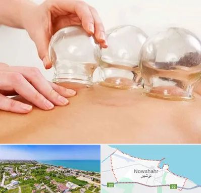 بادکش درمانی در نوشهر