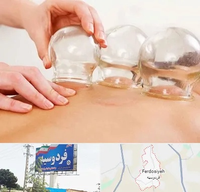 بادکش درمانی در فردوسیه شهریار