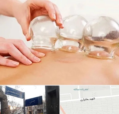 بادکش درمانی در سی متری جی