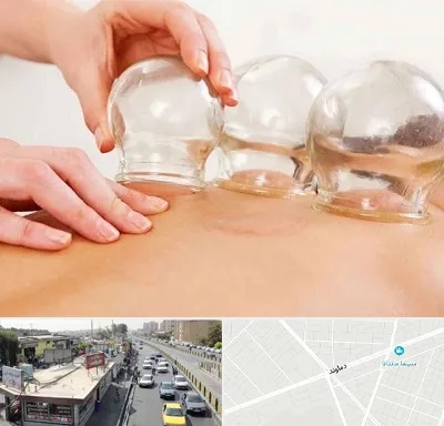 بادکش درمانی در خیابان دماوند