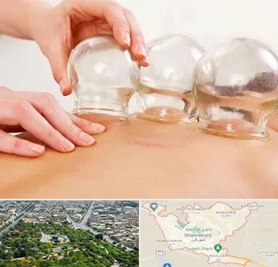 بادکش درمانی در شهرکرد