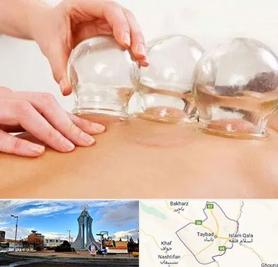 بادکش درمانی در تایباد