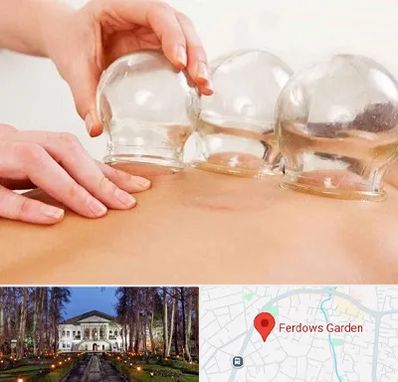 بادکش درمانی در باغ فردوس