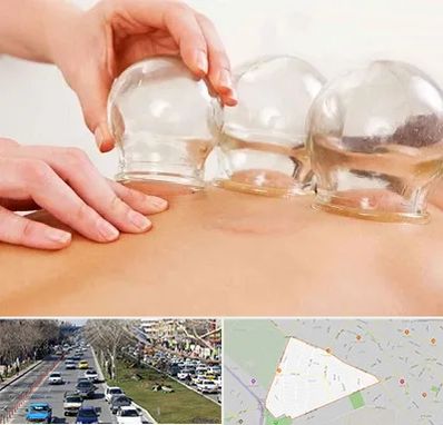 بادکش درمانی در احمدآباد مشهد