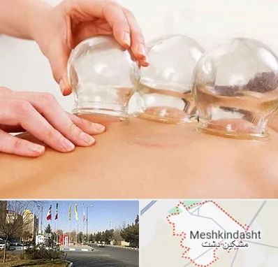 بادکش درمانی در مشکین دشت