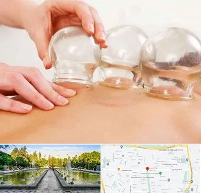 بادکش درمانی در سرسبز