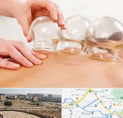 بادکش درمانی در کوی وحدت شیراز