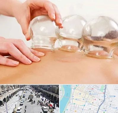 بادکش درمانی در نادری اهواز