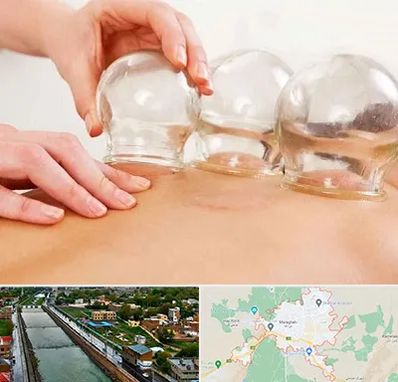 بادکش درمانی در مراغه