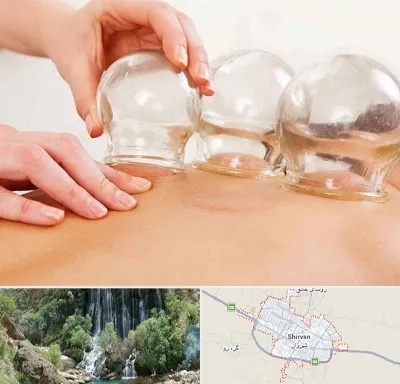 بادکش درمانی در شیروان