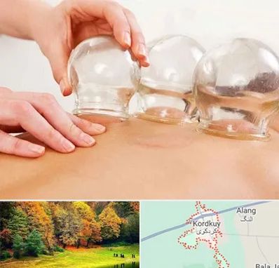 بادکش درمانی در کردکوی