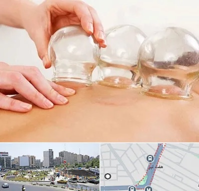 بادکش درمانی در هفت تیر