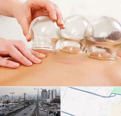 بادکش درمانی در بلوار ارتش