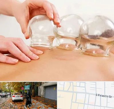 بادکش درمانی در خیابان فلسطین