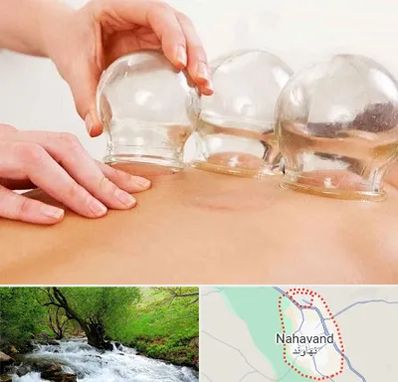 بادکش درمانی در نهاوند