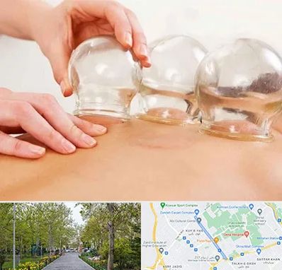 بادکش درمانی در قدوسی غربی شیراز