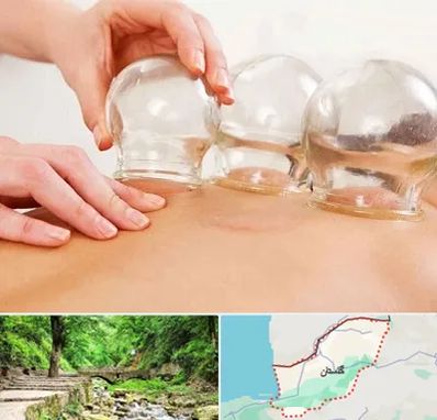 بادکش درمانی در گلستان