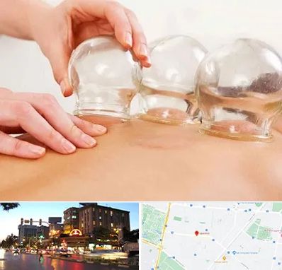 بادکش درمانی در بلوار سجاد مشهد