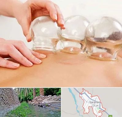 بادکش درمانی در سراوان