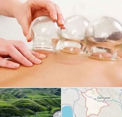 بادکش درمانی در گچساران