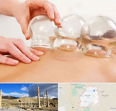 بادکش درمانی در مرودشت