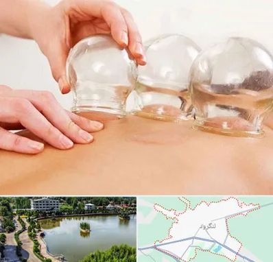 بادکش درمانی در لنگرود