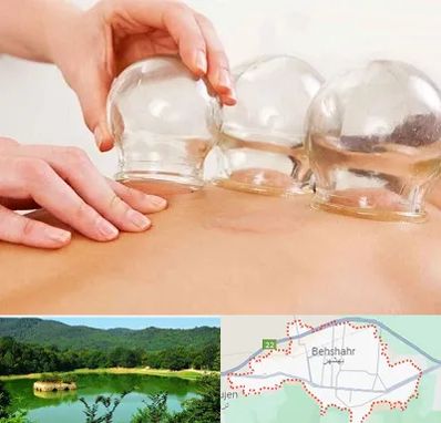 بادکش درمانی در بهشهر
