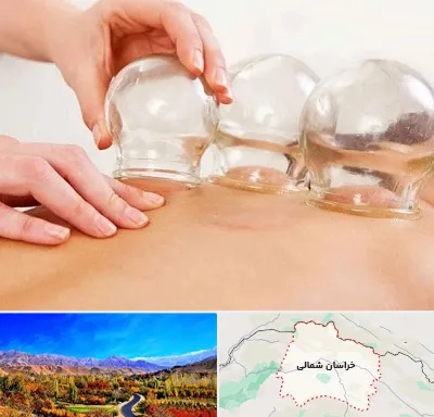 بادکش درمانی در خراسان شمالی