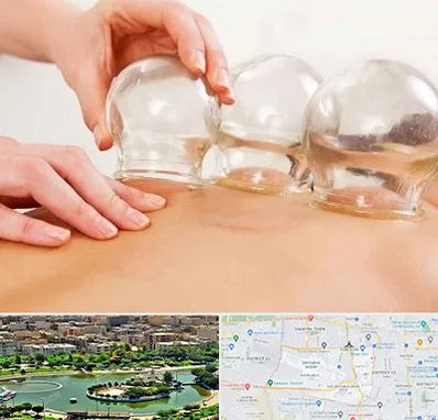 بادکش درمانی در منطقه 9 تهران