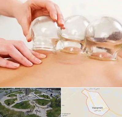 بادکش درمانی در ورامین