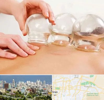 بادکش درمانی در شرق تهران 